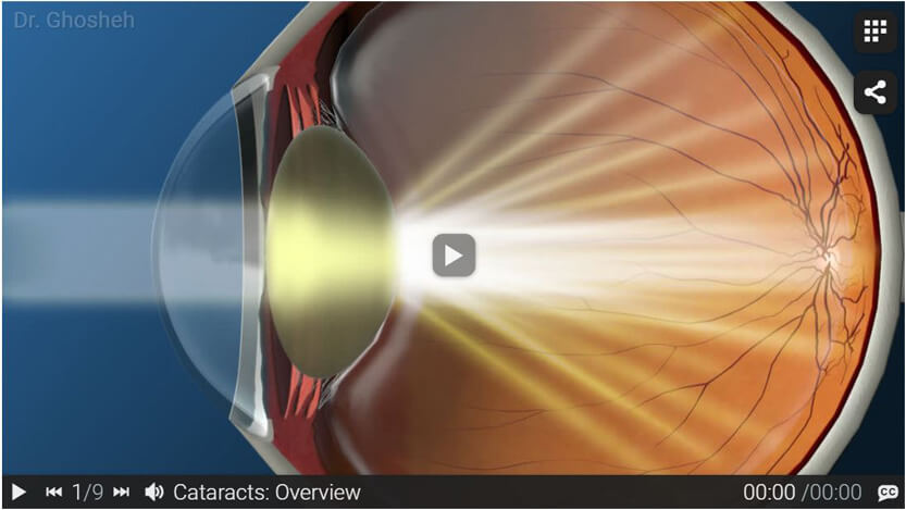 illustration of inner eye Click to see the video