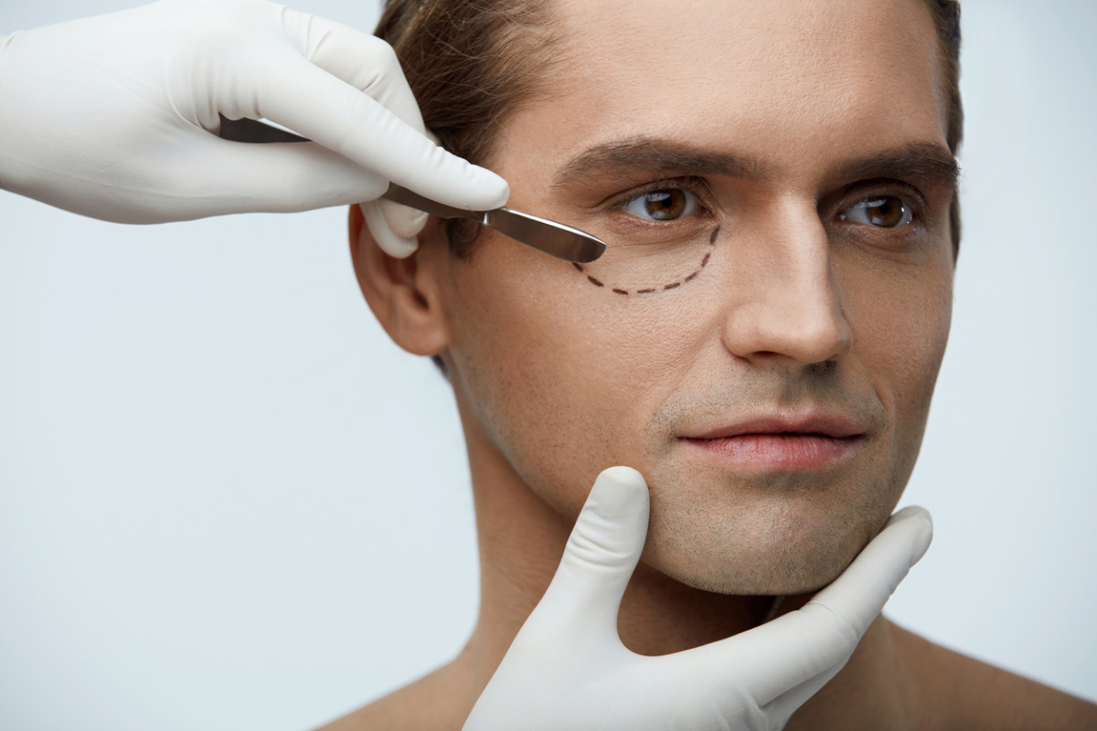 man getting ready for eyelid surgery