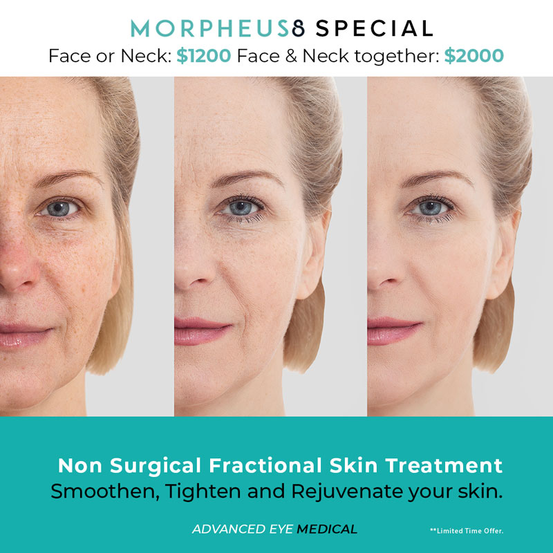 Morpheous8 Special offer image